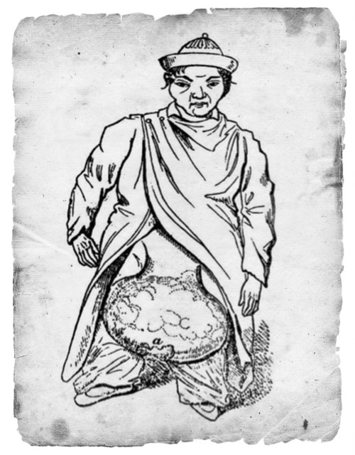 Иллюстрация к книге — Безумная медицина. Странные заболевания и не менее странные методы лечения в истории медицины [i_050.jpg]