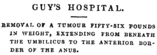 Иллюстрация к книге — Безумная медицина. Странные заболевания и не менее странные методы лечения в истории медицины [i_051.jpg]