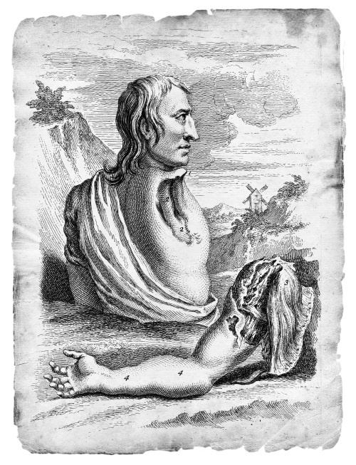 Иллюстрация к книге — Безумная медицина. Странные заболевания и не менее странные методы лечения в истории медицины [i_057.jpg]