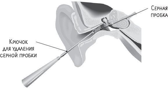 Иллюстрация к книге — В лабиринтах уха, горла и носа. Скрытые механизмы работы, неочевидные взаимосвязи и полезные знания, которые помогут «дотянуть» до визита к врачу [i_009.jpg]