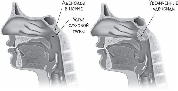Иллюстрация к книге — В лабиринтах уха, горла и носа. Скрытые механизмы работы, неочевидные взаимосвязи и полезные знания, которые помогут «дотянуть» до визита к врачу [i_016.jpg]