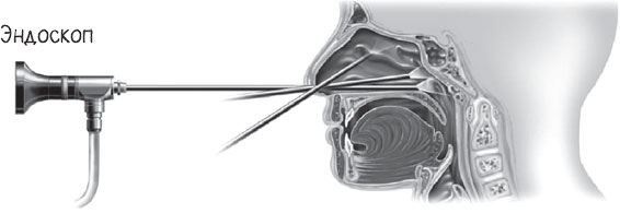 Иллюстрация к книге — В лабиринтах уха, горла и носа. Скрытые механизмы работы, неочевидные взаимосвязи и полезные знания, которые помогут «дотянуть» до визита к врачу [i_022.jpg]