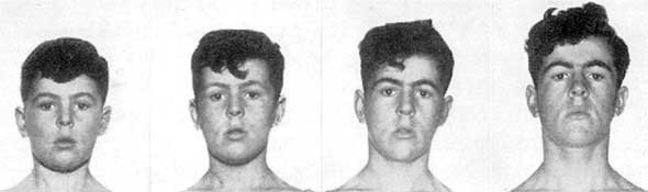 Иллюстрация к книге — Метаморфозы. Путешествие хирурга по самым прекрасным и ужасным изменениям человеческого тела [i_017.jpg]