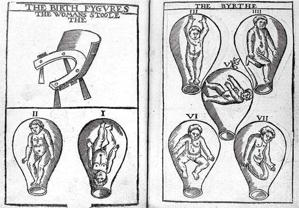 Иллюстрация к книге — Метаморфозы. Путешествие хирурга по самым прекрасным и ужасным изменениям человеческого тела [i_018.jpg]