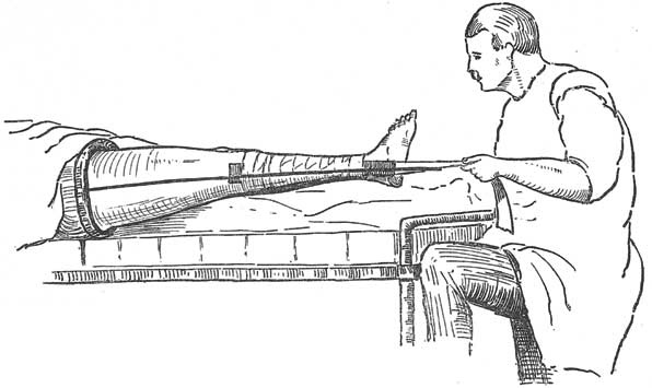 Иллюстрация к книге — Метаморфозы. Путешествие хирурга по самым прекрасным и ужасным изменениям человеческого тела [i_025.jpg]