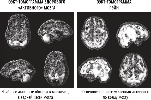 Иллюстрация к книге — Полюби свой мозг [i_008.jpg]
