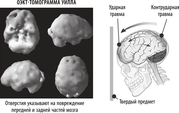 Иллюстрация к книге — Полюби свой мозг [i_018.jpg]