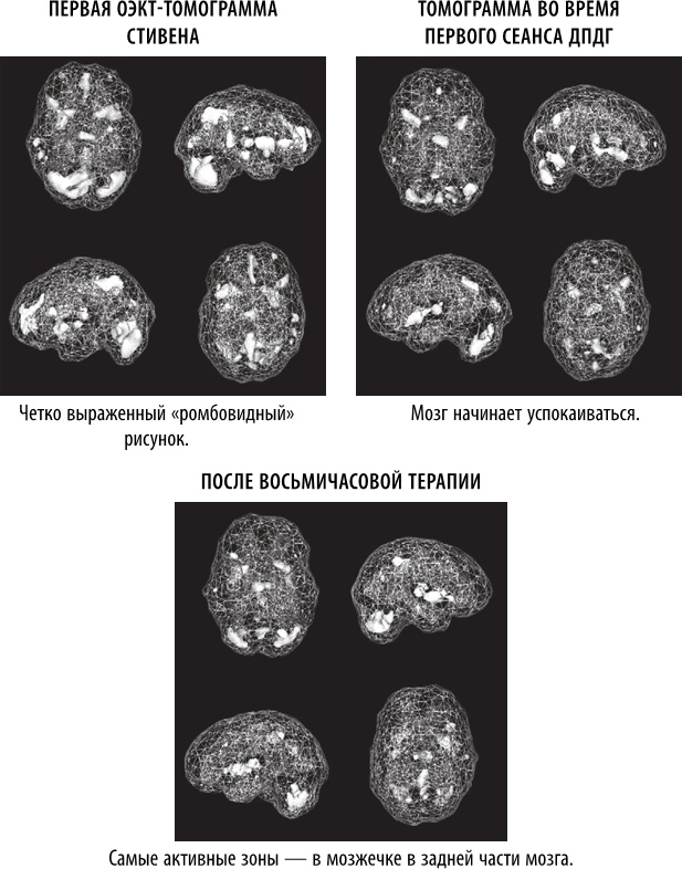 Иллюстрация к книге — Полюби свой мозг [i_028.jpg]