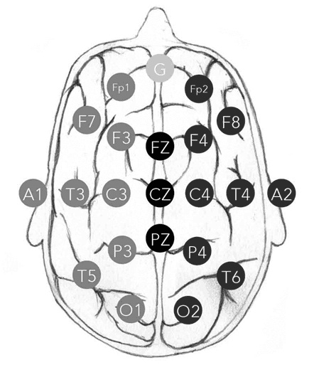 Иллюстрация к книге — Мозговой штурм. Детективные истории из мира неврологии [i_006.jpg]