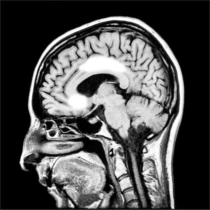 Иллюстрация к книге — Мозг. Как он устроен и что с ним делать [i_057.jpg]