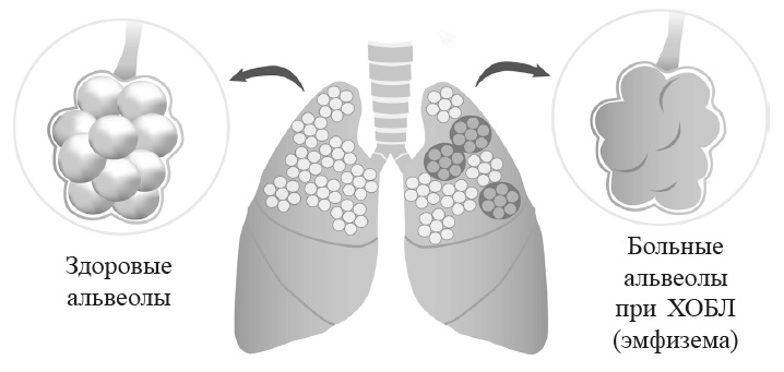 Иллюстрация к книге — Захватывающий мир легких [i_007.jpg]
