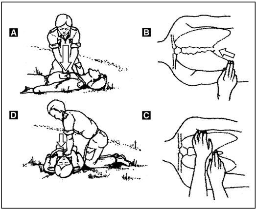 Иллюстрация к книге — Выживание в экстремальных ситуациях. Опыт SAS [i_047.jpg]
