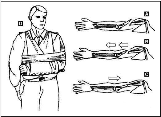 Иллюстрация к книге — Выживание в экстремальных ситуациях. Опыт SAS [i_050.jpg]