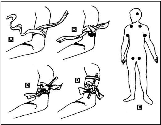 Иллюстрация к книге — Выживание в экстремальных ситуациях. Опыт SAS [i_053.jpg]