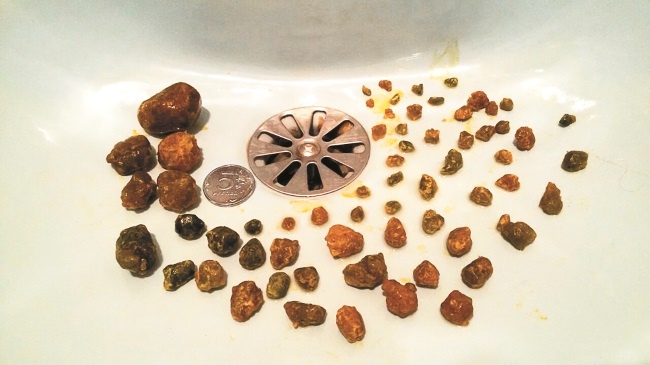 Иллюстрация к книге — Разумный биохакинг Homo Sapiens: физическое тело и его законы [i_027.jpg]