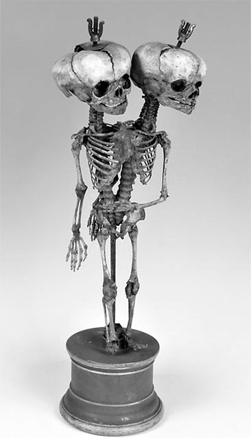 Иллюстрация к книге — Фредерик Рюйш и его дети. Гид по ранним коллекциям Кунсткамеры [i_008.jpg]