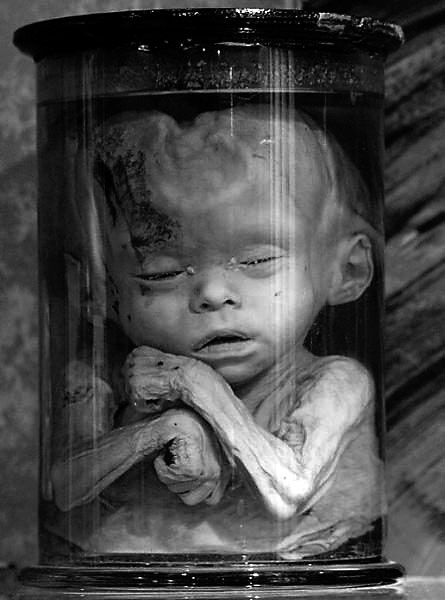 Иллюстрация к книге — Фредерик Рюйш и его дети. Гид по ранним коллекциям Кунсткамеры [i_010.jpg]