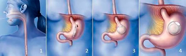 Иллюстрация к книге — Похудеть – это просто [_39.jpg]