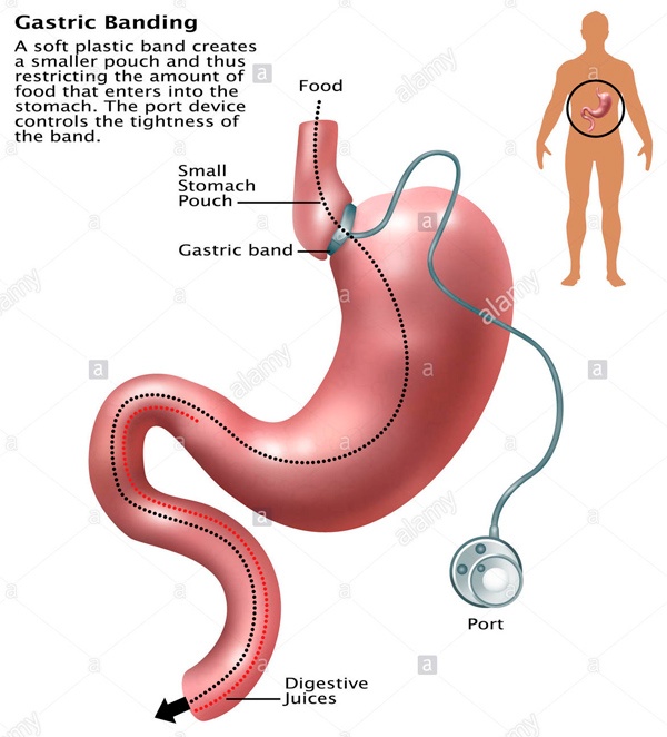 Иллюстрация к книге — Похудеть – это просто [_40.jpg]