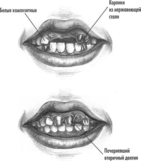Иллюстрация к книге — Естественное лечение кариеса. Реминерализация и восстановление зубов при помощи питания [i_028.jpg]
