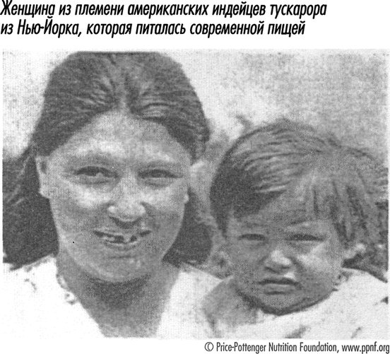 Иллюстрация к книге — Естественное лечение кариеса. Реминерализация и восстановление зубов при помощи питания [i_029.jpg]