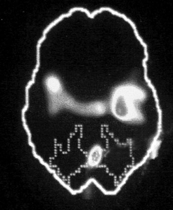 Иллюстрация к книге — Тело помнит все [i_003.jpg]