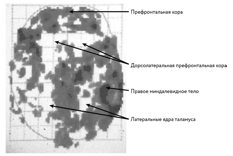 Иллюстрация к книге — Тело помнит все [i_012.jpg]