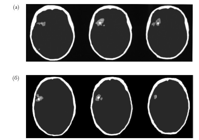 Иллюстрация к книге — Креативный мозг. Как рождаются идеи, меняющие мир [i_013.jpg]