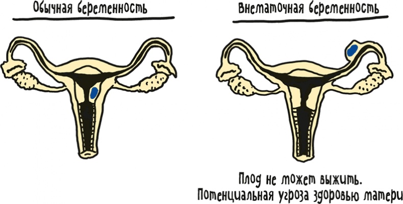 Иллюстрация к книге — Если бы наши тела могли говорить. Руководство по эксплуатации и обслуживанию человеческого тела [i_045.jpg]