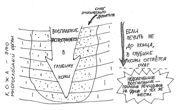 Иллюстрация к книге — Аллергия и как с ней жить. Руководство для всей семьи [i_035.jpg]