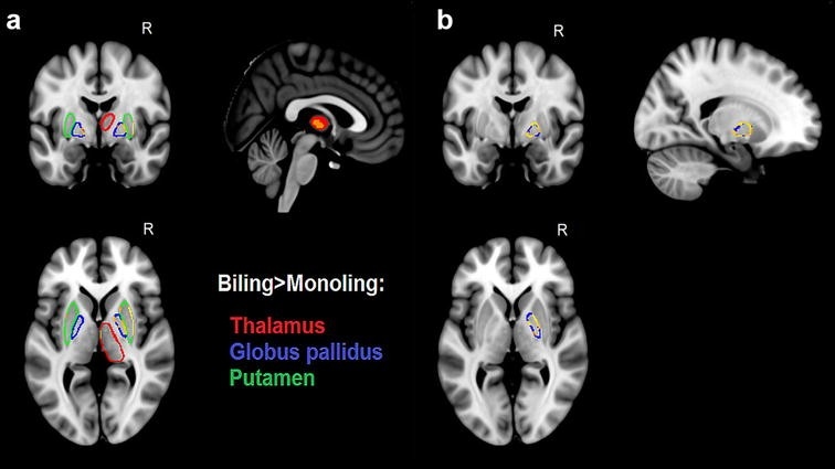 Иллюстрация к книге — Язык и мозг. Нейробиология раскрывает главную тайну человека [_25.jpg]