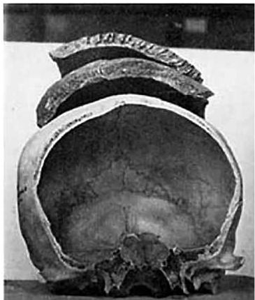 Иллюстрация к книге — Челюсти. Научное исследование о взаимосвязи между зубами, мозгом и кишечником + 40-дневный план питания, который поможет вернуть в норму здоровье ротовой полости и сформировать иммунитет к кариесу [i_028.jpg]