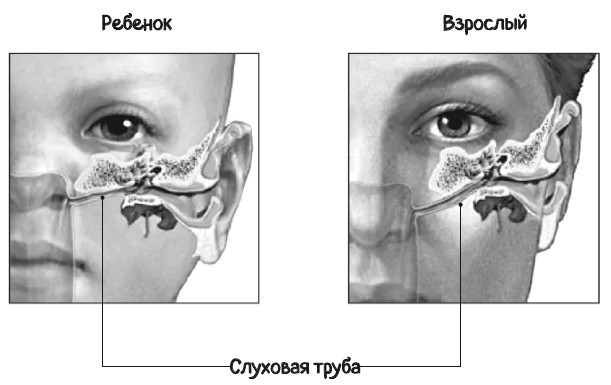 Иллюстрация к книге — Почему болит ухо. Что делать при отитах, снижении слуха и звоне в ушах – правила доказательной медицины [i_010.jpg]