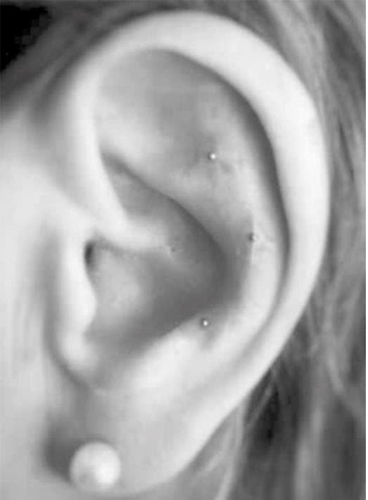 Иллюстрация к книге — Чуткое ухо. Что может рассказать о вашем здоровье ушная раковина [i_072.jpg]