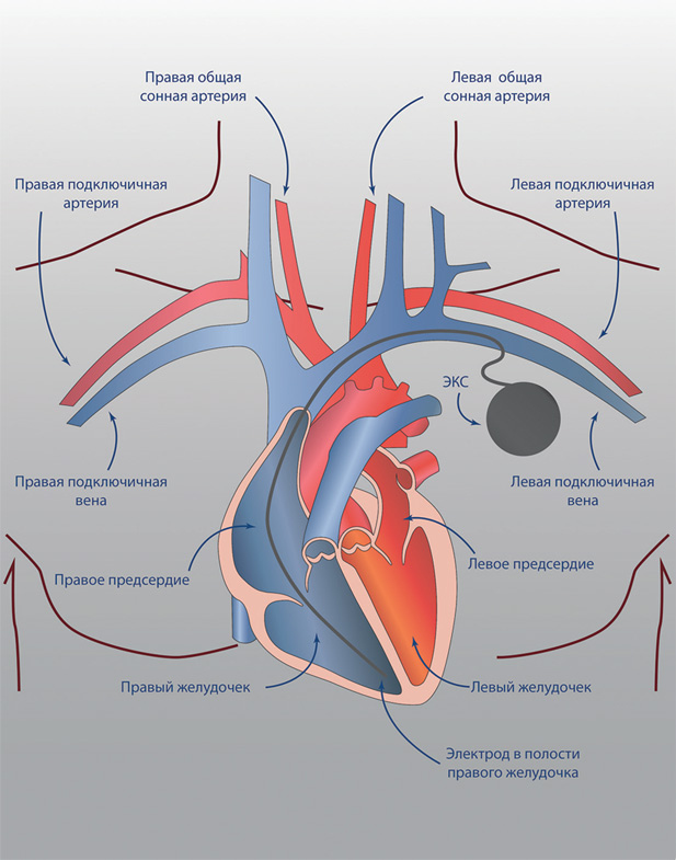 Иллюстрация к книге — Как жить после инфаркта [i_012.jpg]