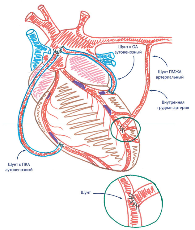 Иллюстрация к книге — Как жить после инфаркта [i_018.jpg]
