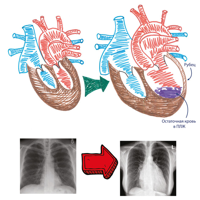Иллюстрация к книге — Как жить после инфаркта [i_020.jpg]