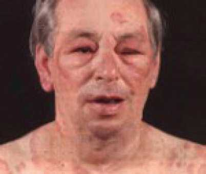 Иллюстрация к книге — Аллергия. Истинные причины. Лечение [i_013.jpg]