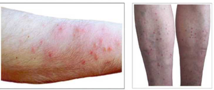 Иллюстрация к книге — Аллергия. Истинные причины. Лечение [i_017.jpg]