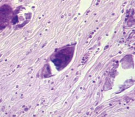 Иллюстрация к книге — Аллергия. Истинные причины. Лечение [i_018.jpg]