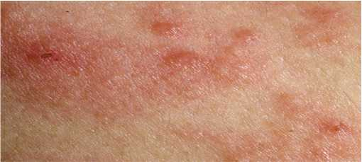 Иллюстрация к книге — Аллергия. Истинные причины. Лечение [i_023.jpg]