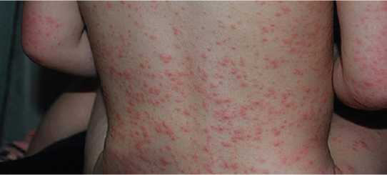 Иллюстрация к книге — Аллергия. Истинные причины. Лечение [i_026.jpg]