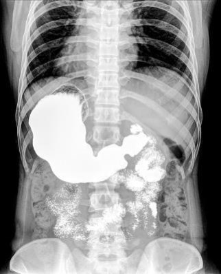 Иллюстрация к книге — Взламывая анатомию [image200.jpg]