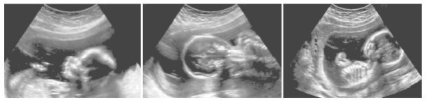 Иллюстрация к книге — Взламывая анатомию [image243.jpg]