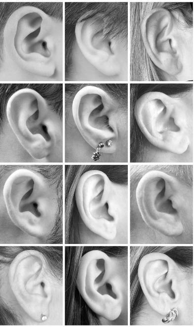 Иллюстрация к книге — Взламывая анатомию [image254.jpg]