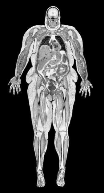 Иллюстрация к книге — Взламывая анатомию [image48.jpg]