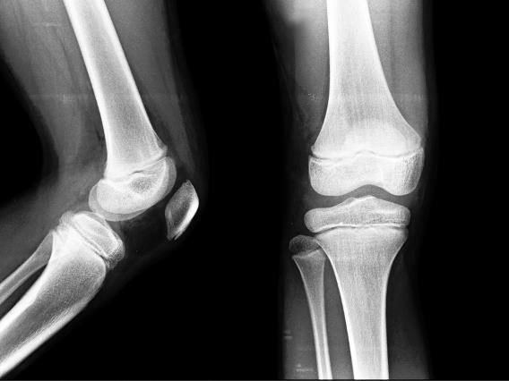 Иллюстрация к книге — Взламывая анатомию [image71.jpg]