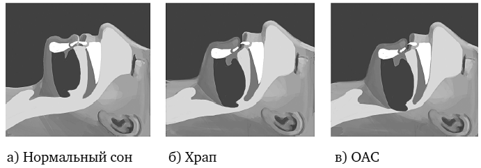 Иллюстрация к книге — Укус эволюции. Откуда у современного человека неправильный прикус, кривые зубы и другие деформации челюсти [i_042.jpg]