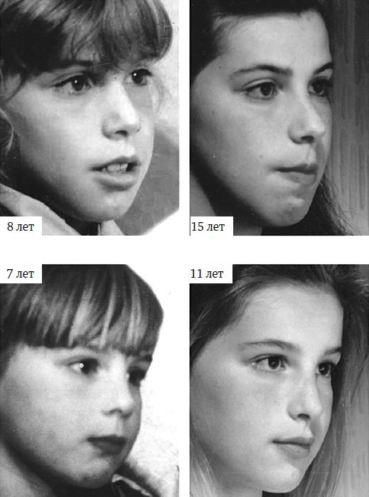 Иллюстрация к книге — Укус эволюции. Откуда у современного человека неправильный прикус, кривые зубы и другие деформации челюсти [i_043.jpg]