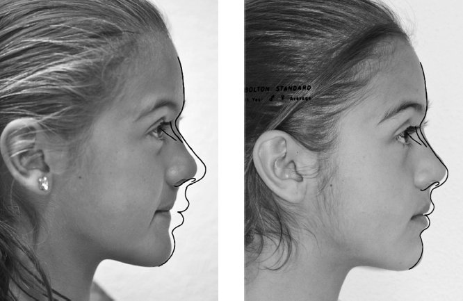 Иллюстрация к книге — Укус эволюции. Откуда у современного человека неправильный прикус, кривые зубы и другие деформации челюсти [i_055.jpg]